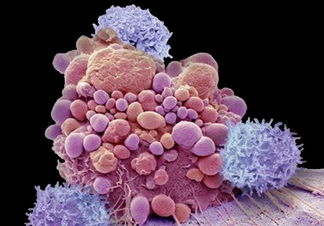 این ماده غذایی خواص ضد سرطان دارد این ماده غذایی خواص ضد سرطان دارد