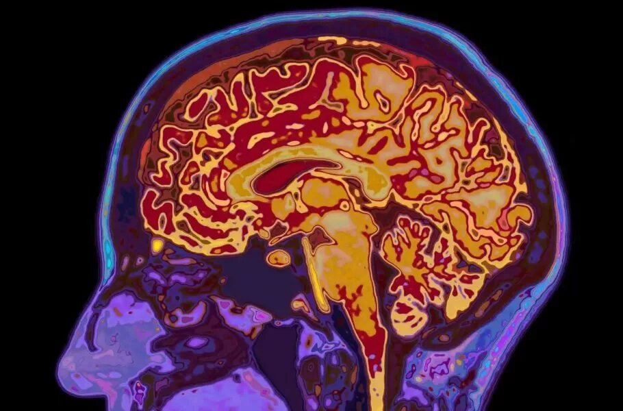 فلسفه ذهن چیست و چه کاربردی دارد؟